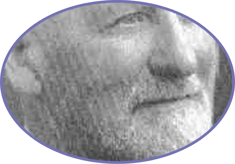 Close-up of a vintage grayscale portrait focusing on the lower half of a face, including a partial view of a nose and mouth. The image is oval-shaped with a blurred texture, framed by a thin blue border.